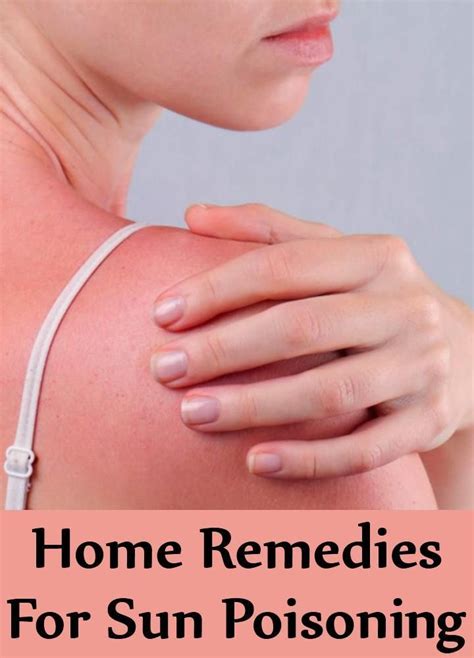 Home Remedies For Sun Poisoning | Home remedies, Sun poisoning treatment, Remedies