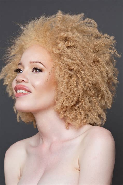 58 Albino People Who'll Mesmerize You With Their Otherworldly Beauty | Bored Panda