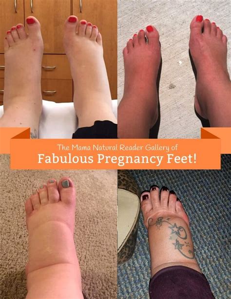 How To Reduce Feet Swelling During Pregnancy - Stuffjourney ...