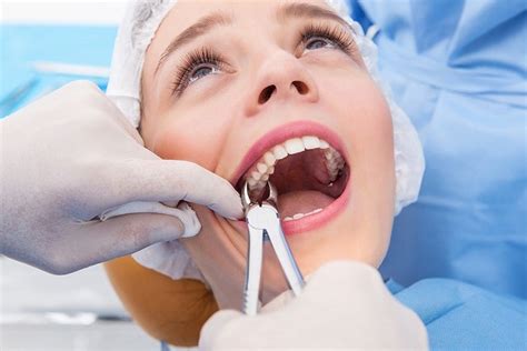 How Long Is Wisdom Teeth Surgery – Boston Dentist – Congress Dental Group 160 Federal St Floor 1 ...