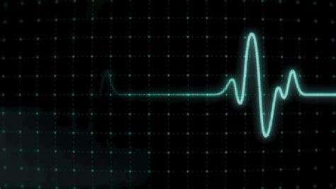 Animated Ecg Eeg Gif