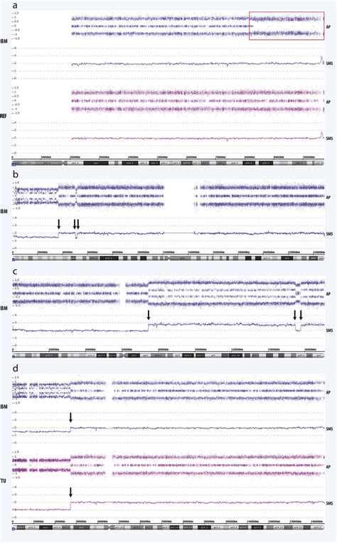 e SNP array profiles of BM-derived DTCs. a. SNP array data from an... | Download Scientific Diagram