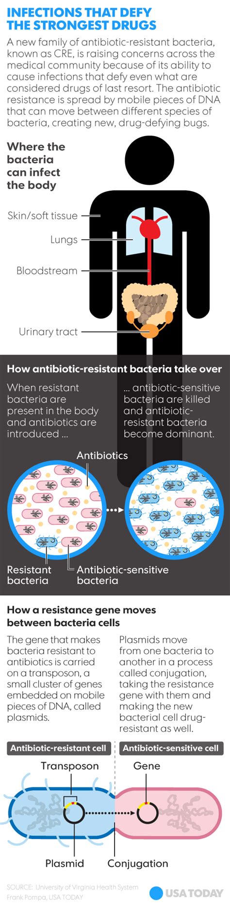 CRE bacteria on medical scopes kills up to 40 percent of people it infects