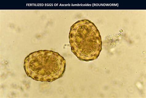 Ascaris lumbricoides (Roundworm) Eggs: Morphology, Characteristics and ...