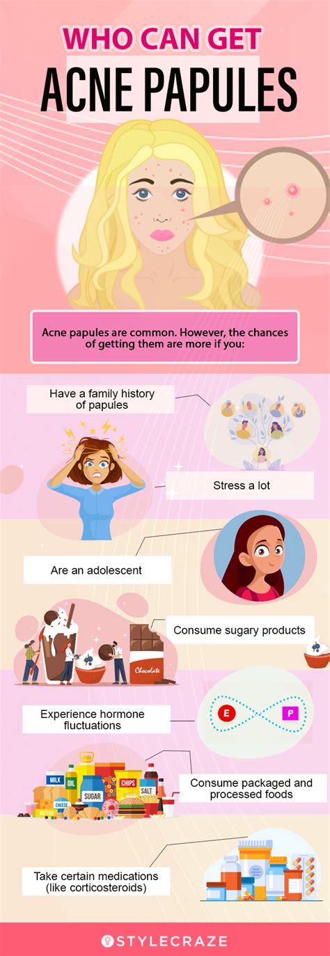 Types Of Acne: The Differences Between Your Bumps And, 60% OFF