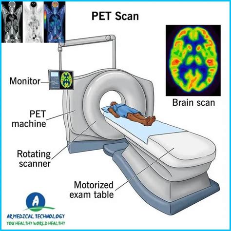 MRI Vs CT Scan Vs PET Scan Best Way To Learn24