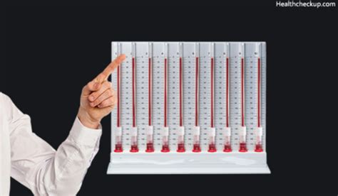 ESR Test Procedure, Normal Ranges and Causes of Low and High ESR