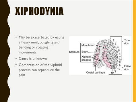 Xiphoid Process Pain