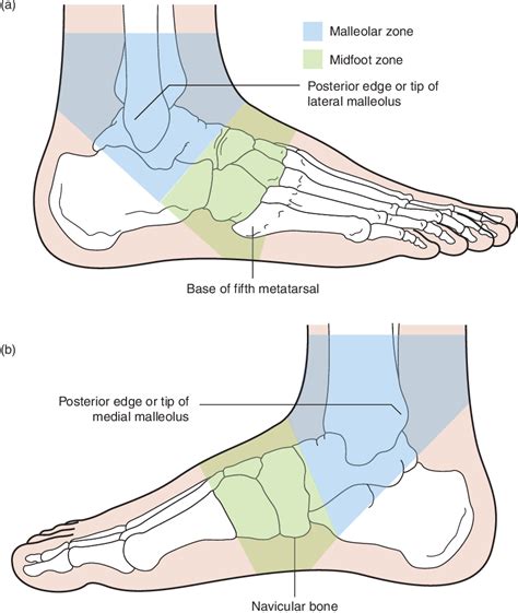 Soft-tissue ankle injuries | Semantic Scholar