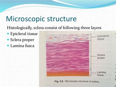 Sclera