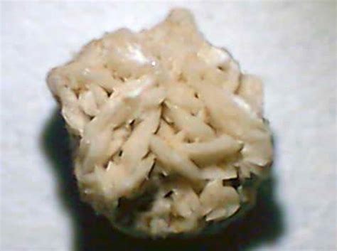 Kidney stone containing calcium oxalate and uric acid crystals ...