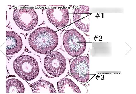 cross section of seminiferous tubules at 400x Diagram | Quizlet