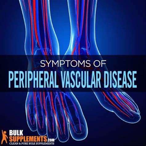 Peripheral Vascular Disease: Symptoms, Causes & Treatment