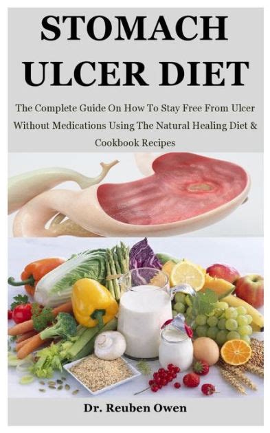 Stomach Ulcer Diet: The Complete Guide On How To Stay Free From Ulcer Without Medications Using ...