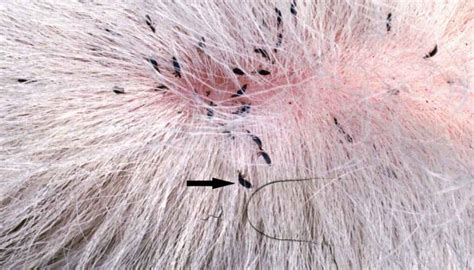 7 Tiny Black Bugs On Dogs (No, These Are NOT Fleas)