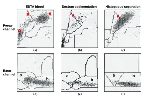 Presentation of blood cells on the ADVIA-120 blood cell counter before... | Download Scientific ...