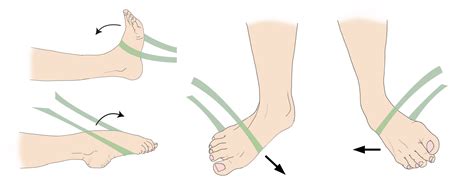 Sprained Ankle - OrthoInfo - AAOS