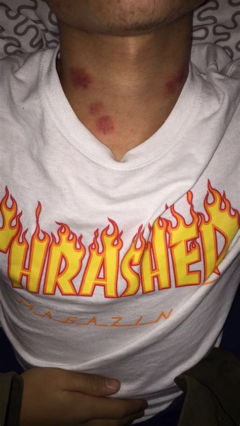 Relationship goals My boyfriend Hickeys Boys Couple | Hickies, Cute couple pictures, Hickeys