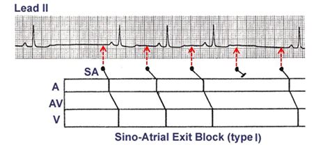 ECG Learning Center - An introduction to clinical electrocardiography