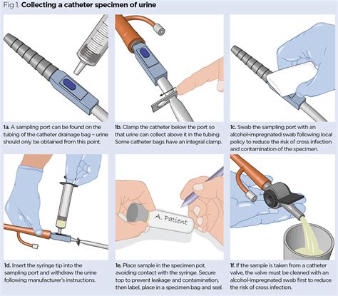 Catheter Urine Sample Collection Procedure for NMC OSCE Exam - OSCE Trainer