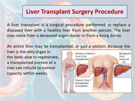 Liver transplant surgery and Procedure