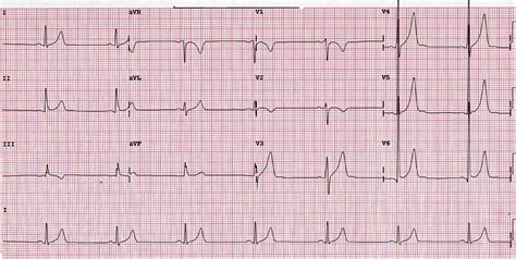 What’s a normal heart rate? – Dr John M