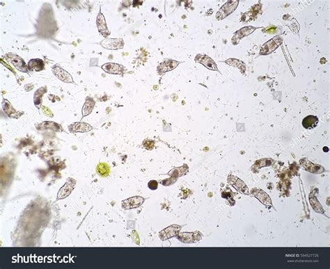 Freshwater Aquatic Plankton Under Microscope View Stock Photo 594527726 | Shutterstock