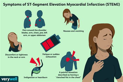 STEMI Heart Attacks and Why They Are So Dangerous