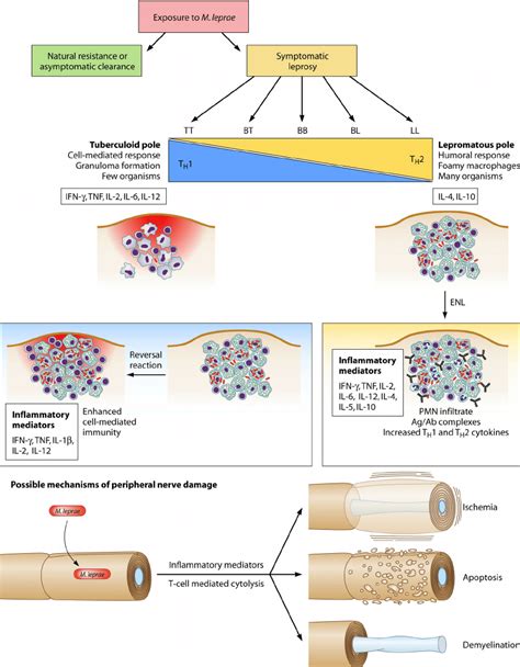 The leprosy spectrum and possible mechanisms of tissue damage. Leprosy... | Download Scientific ...