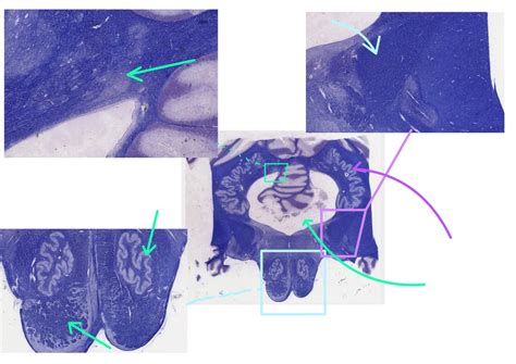 histology 2: base of pons/ upper medulla Diagram | Quizlet