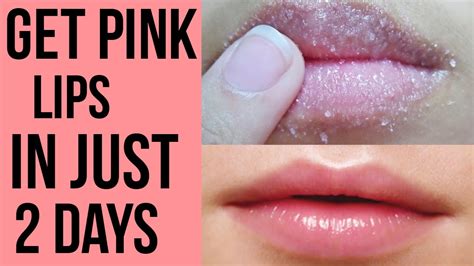 How To Remove Dark Lips Permanently | Lipstutorial.org