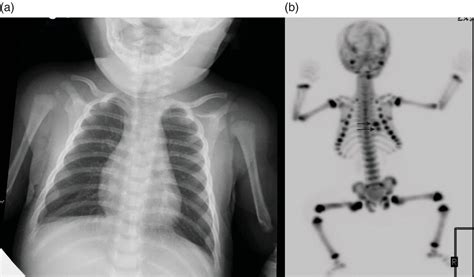 Imaging of Pediatric Diseases | Radiology Key