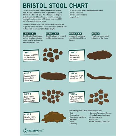 Bristol Stool Chart | Poster Of Bristol Stool Chart | AntomyStuff