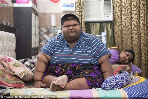 World's fattest child Mihir Jain from India loses 10-stone | Daily Mail Online