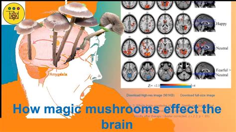 How magic mushrooms effect the Brain 🧠 AMYGDALA EMOTIONAL CENTER - YouTube