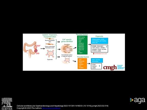 New paper on colorectal cancer organoid modelling – LBI for Applied ...