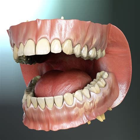 3d model orthodontics mouth teeth