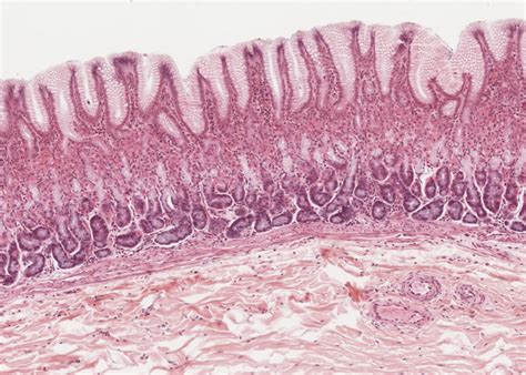 Digestive System – Meyers Histology