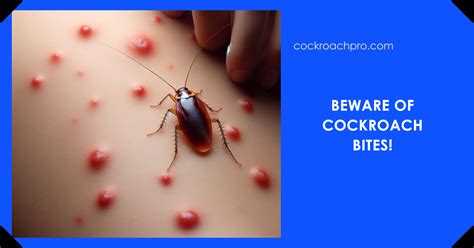 Do cockroaches bite?: The Truth Is Revealed Today - cockroachpro