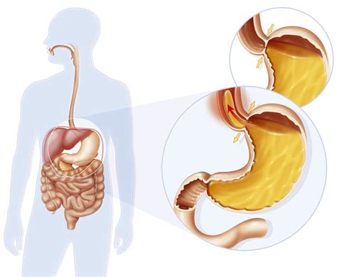 Sphincters: Where They're Found and Purpose