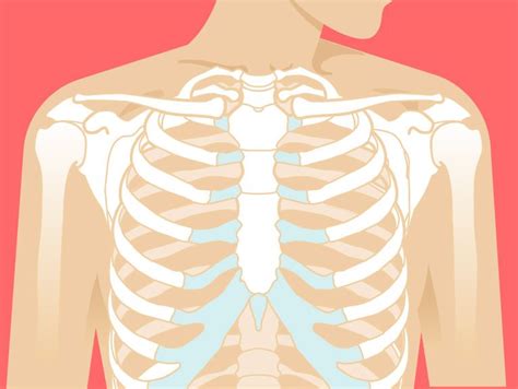 Broken Sternum: Symptoms, Car Accident, Treatment, and More