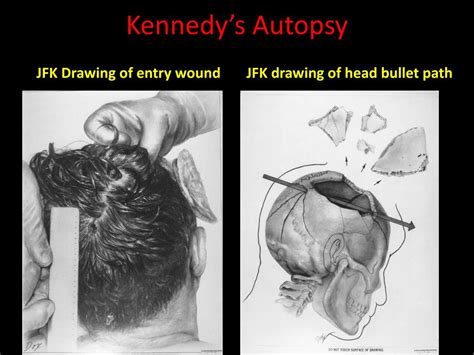 PPT - JFK PowerPoint Presentation, free download - ID:4711271