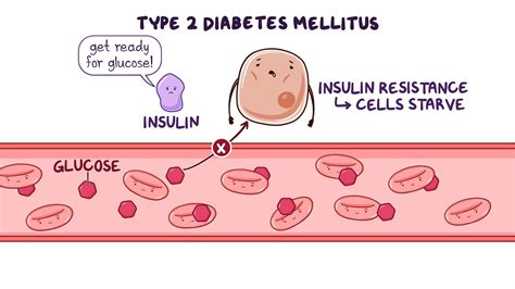 Antidiabetic Therapy - Non-insulin/Oral Antidiabetic Drugs - Osmosis ...