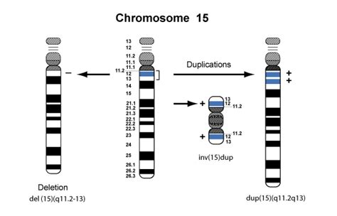 Frankie & Chromosome 15 Duplication Syndrome - Part 1 - Frankies Legacy