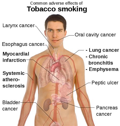 Smoking health risks : Health effects of smoking