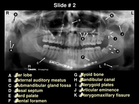 Self study-pan-anatomy