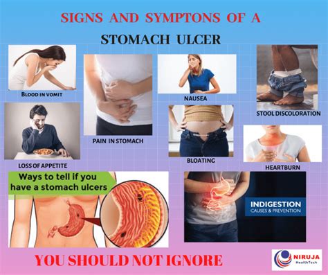 Peptic Ulcer: a Painful Ulceration in the Stomach