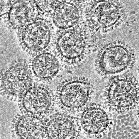 Electron Microscope Images Virus