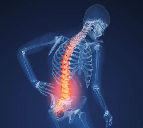 How Physical Therapy Can Help Back Pain