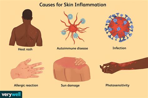 Skin Inflammation: Causes and Treatments